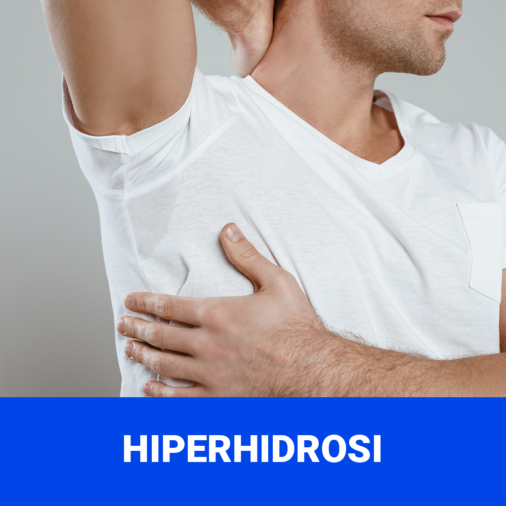 hiperhidrosi